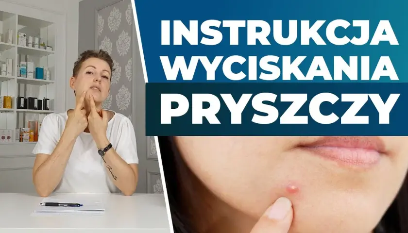 Jak szybko wysuszyć pryszcza? Ekspert radzi: dom i apteka